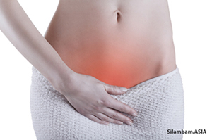 bacterial vaginosis 1