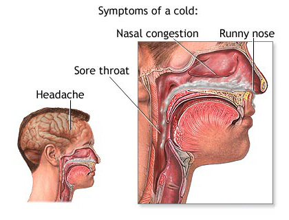 Common Cold 2